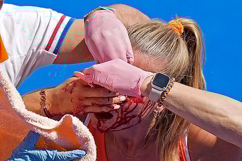 Netherlands' Joosje Burg is attended after getting injured during the women's semifinal